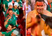 APUÑALAN A AFICIONADO DEL TRI EN PARTIDO DE LA COPA DE ORO FRENTE A QATAR